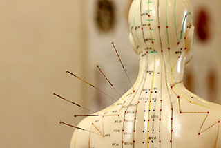 Akupunktur bei Heuschnupfen